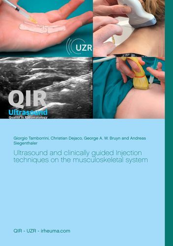 Ultrasound_and_clinically_guided_Injection_techniques_on_the_musculoskeletal_system.jpeg#asset:1137